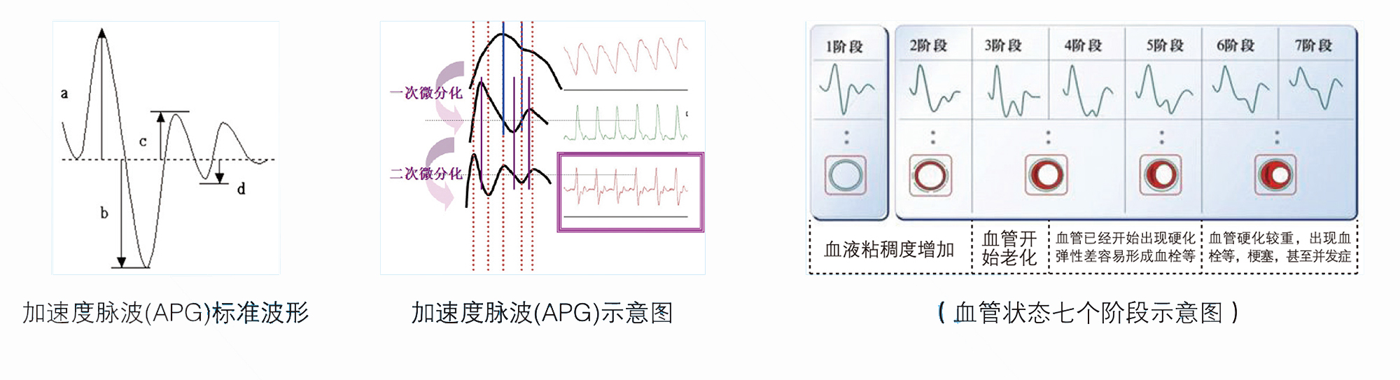 精神壓力分析儀