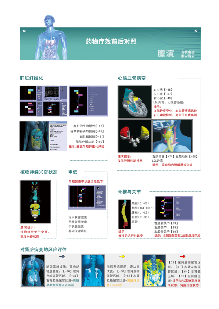 糖尿病早期無創(chuàng)檢測儀