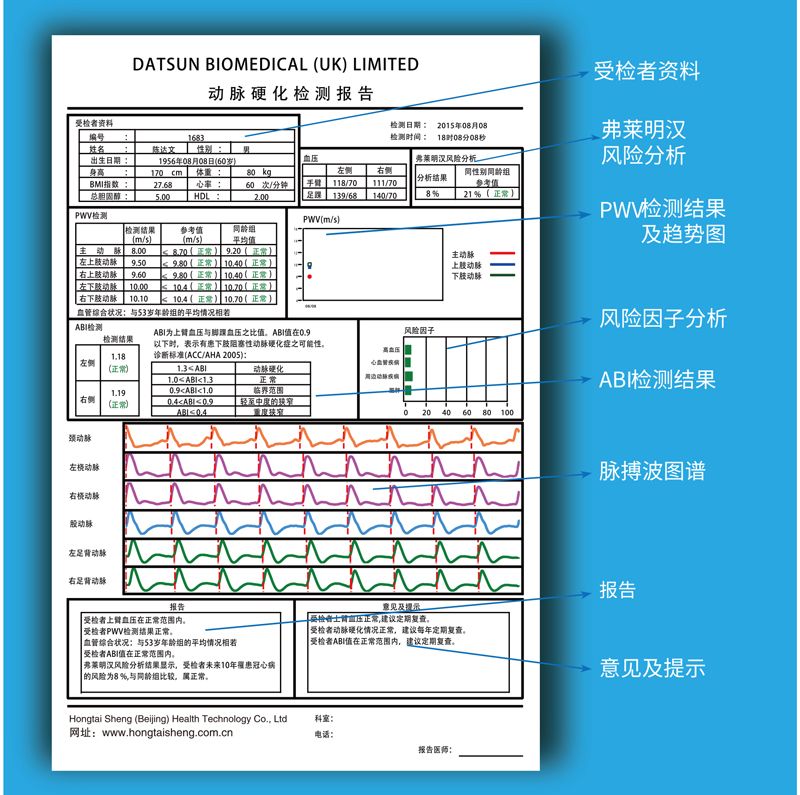 動(dòng)脈硬化檢測儀