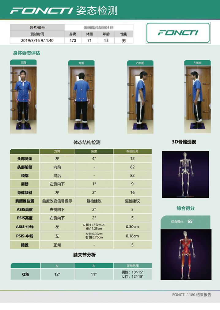 步態(tài)分析系統(tǒng)產(chǎn)品報告