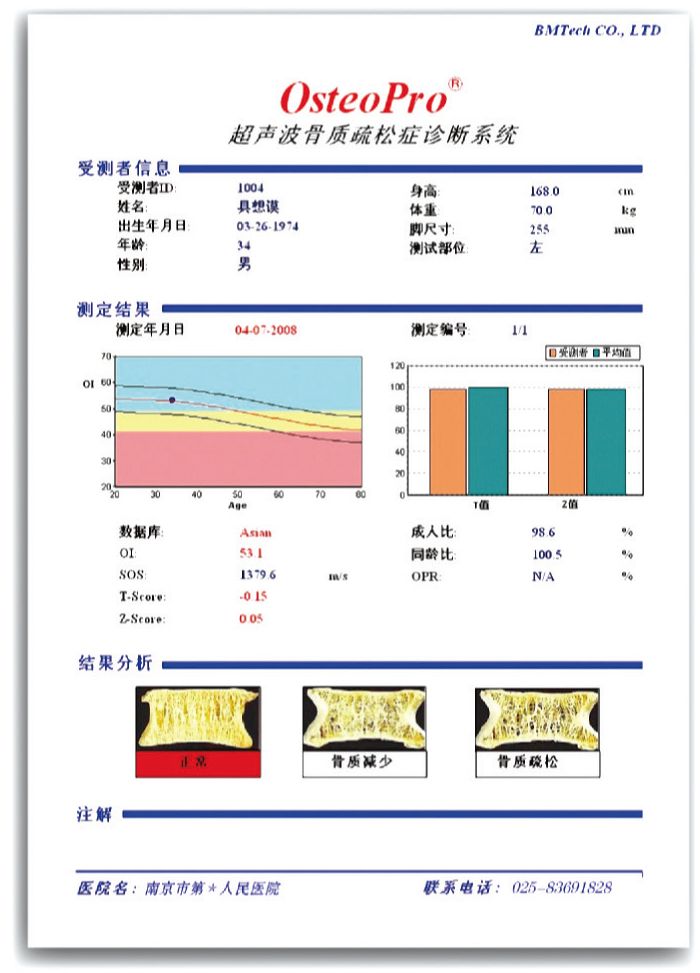 超聲骨密度儀