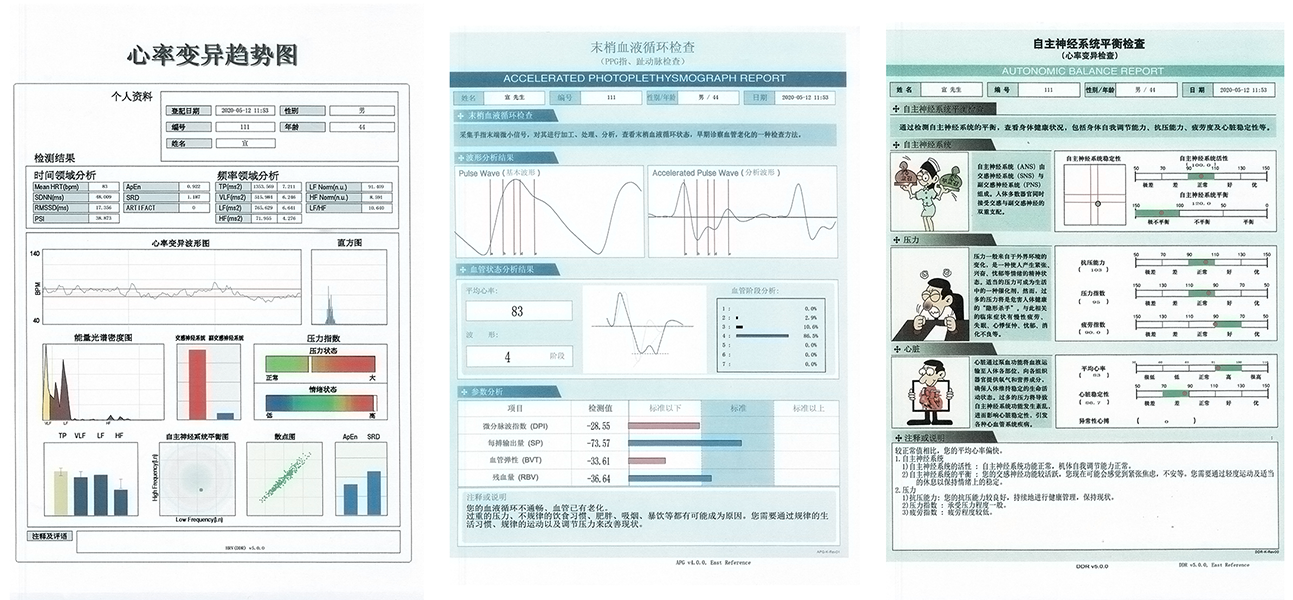 精神壓力分析儀