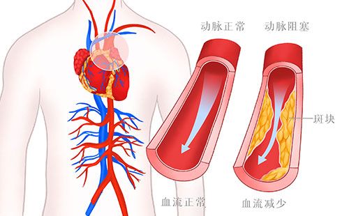 動(dòng)脈硬化檢測(cè)儀