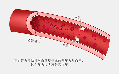 動(dòng)脈硬化檢測(cè)儀