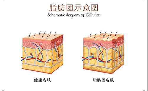 人體成分分析儀