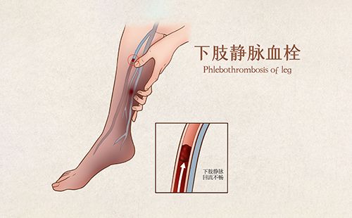 動(dòng)脈硬化檢測(cè)儀