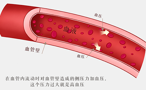 動脈硬化檢測儀