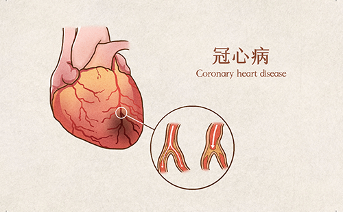 動(dòng)脈硬化檢測(cè)儀