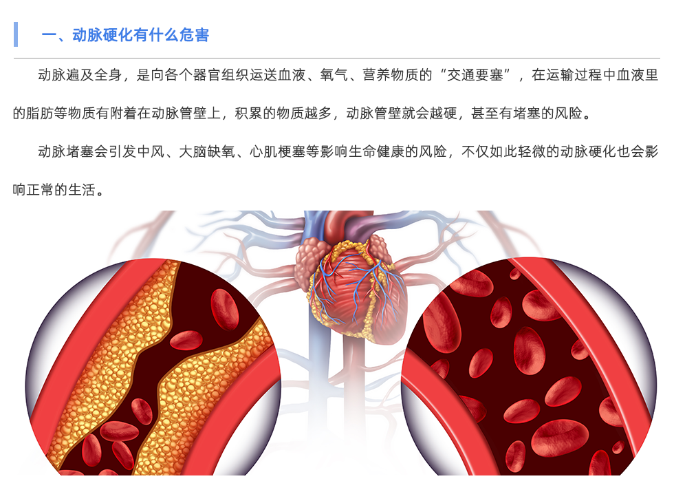 動(dòng)脈硬化檢測(cè)儀