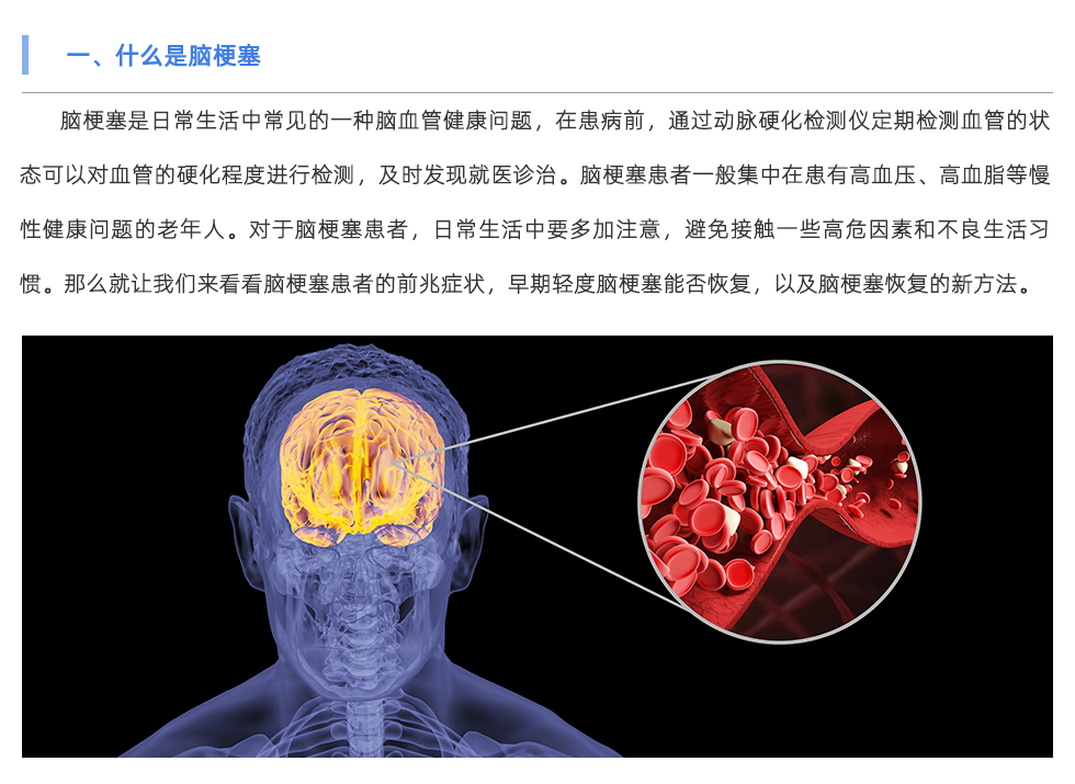 動(dòng)脈硬化檢測(cè)儀