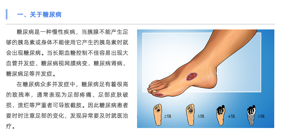 定制鞋墊