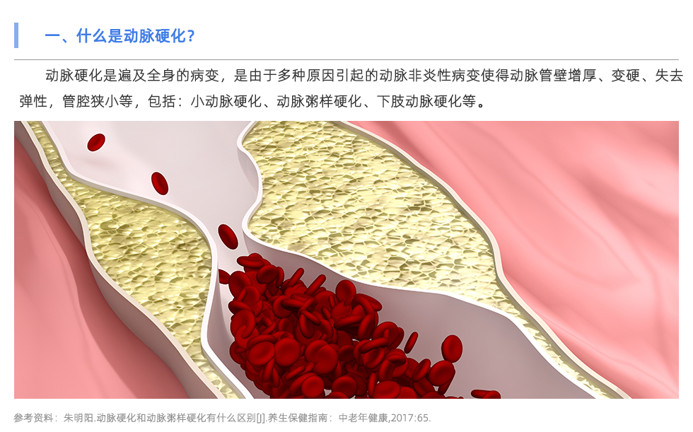 動脈硬化檢測儀