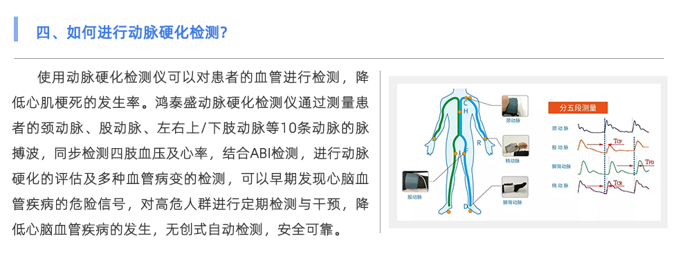 動脈硬化檢測儀