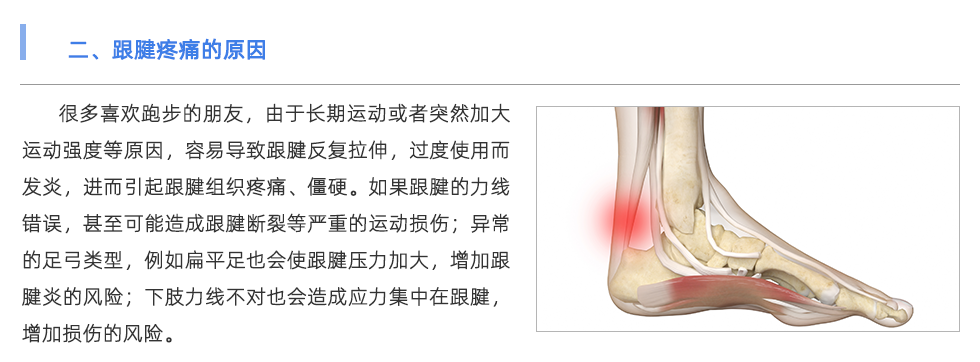 定制鞋墊