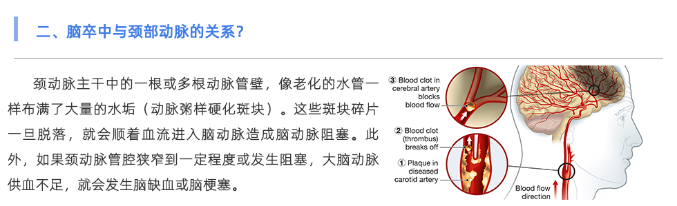 動(dòng)脈硬化檢測(cè)儀