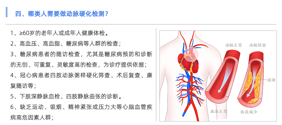 動(dòng)脈硬化檢測儀