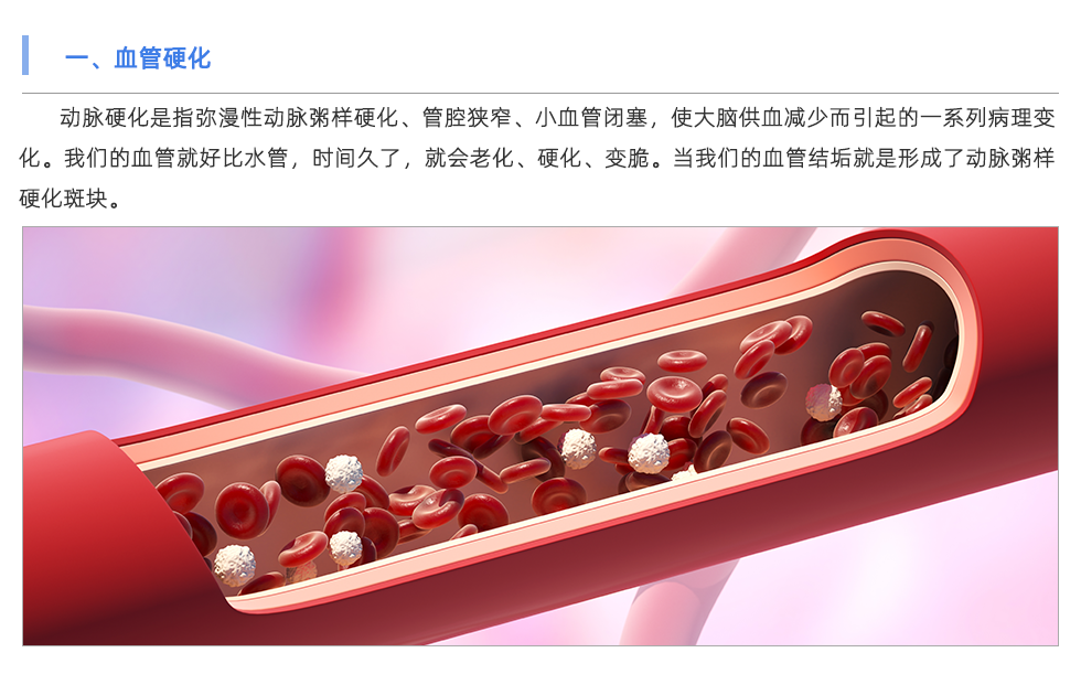 動脈硬化檢測儀