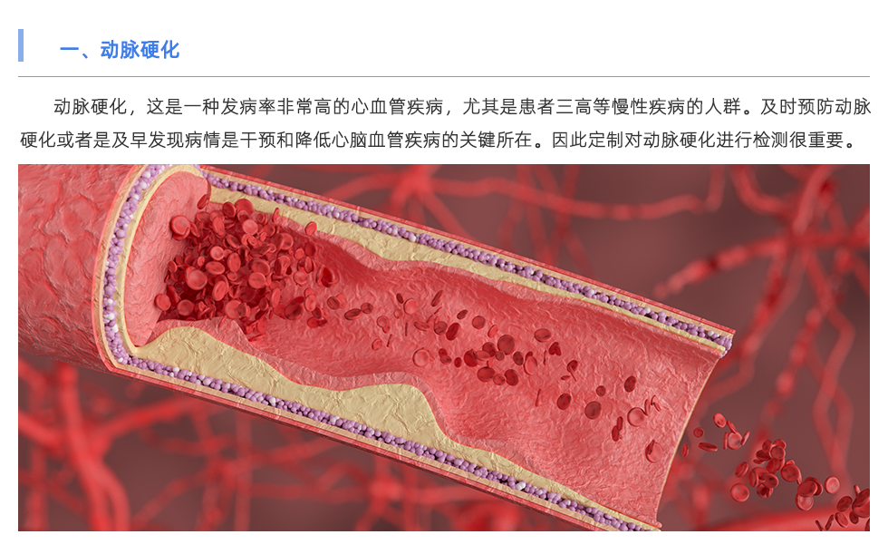 動(dòng)脈硬化檢測(cè)儀