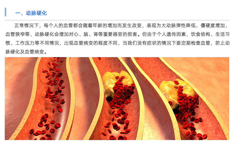 動(dòng)脈硬化檢測(cè)儀