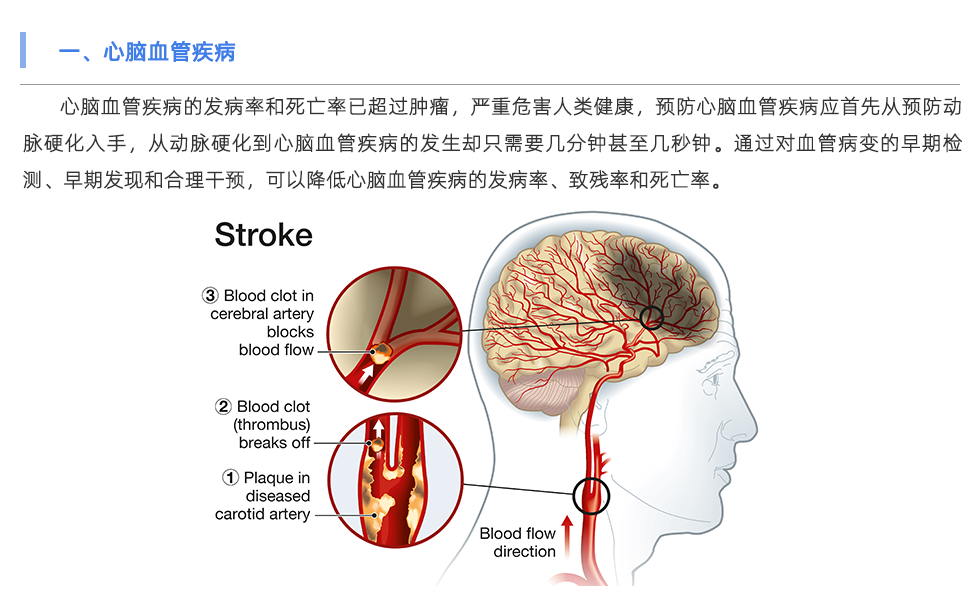 動(dòng)脈硬化檢測(cè)儀