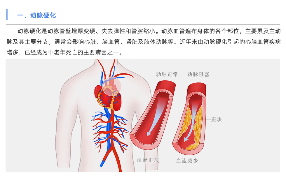 動脈硬化檢測儀