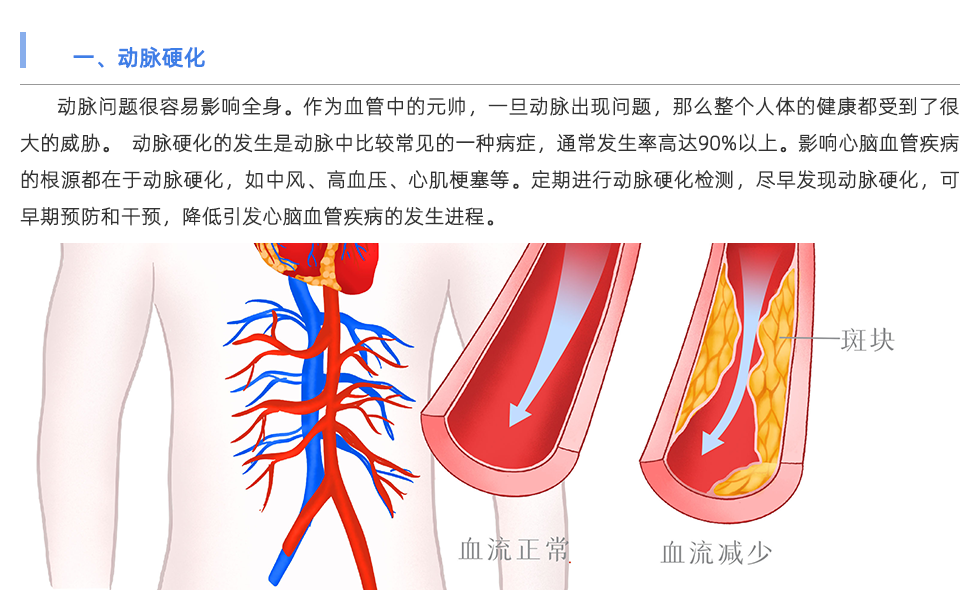 動脈硬化檢測儀