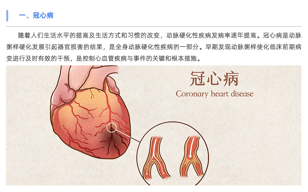 動脈硬化檢測儀