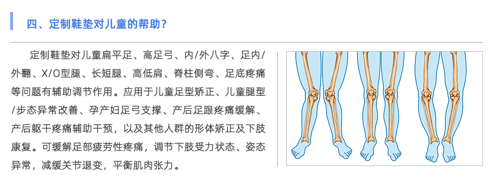 定制鞋墊