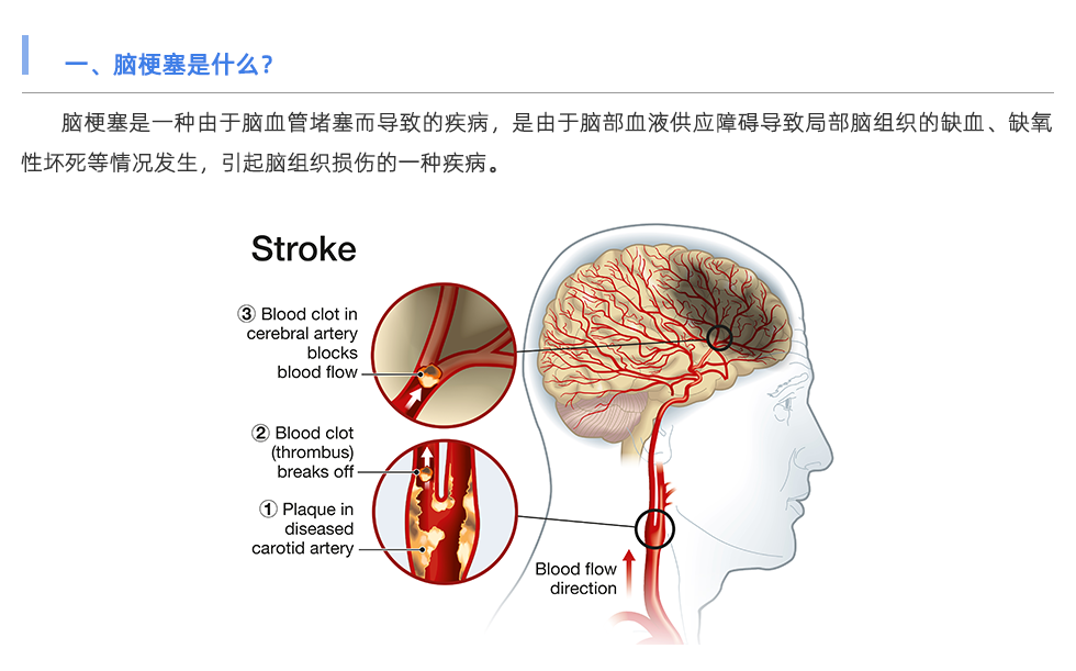 動(dòng)脈硬化檢測(cè)儀