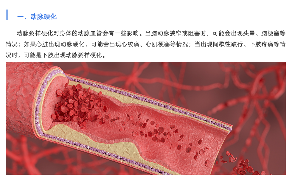 動脈硬化檢測儀