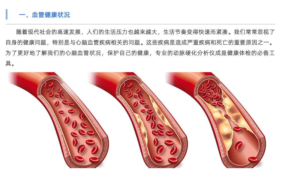 動脈硬化分析儀