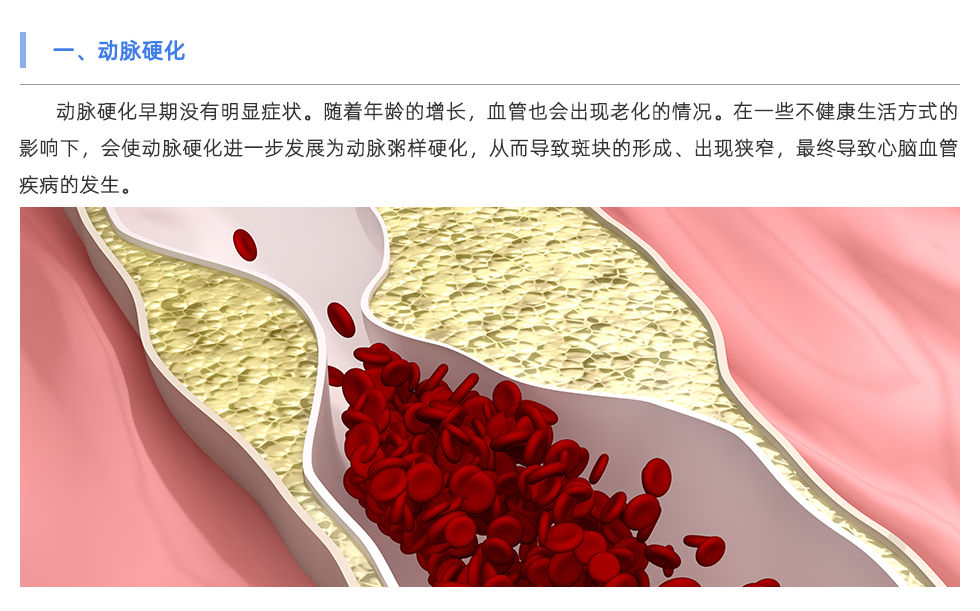 動脈硬化分析儀