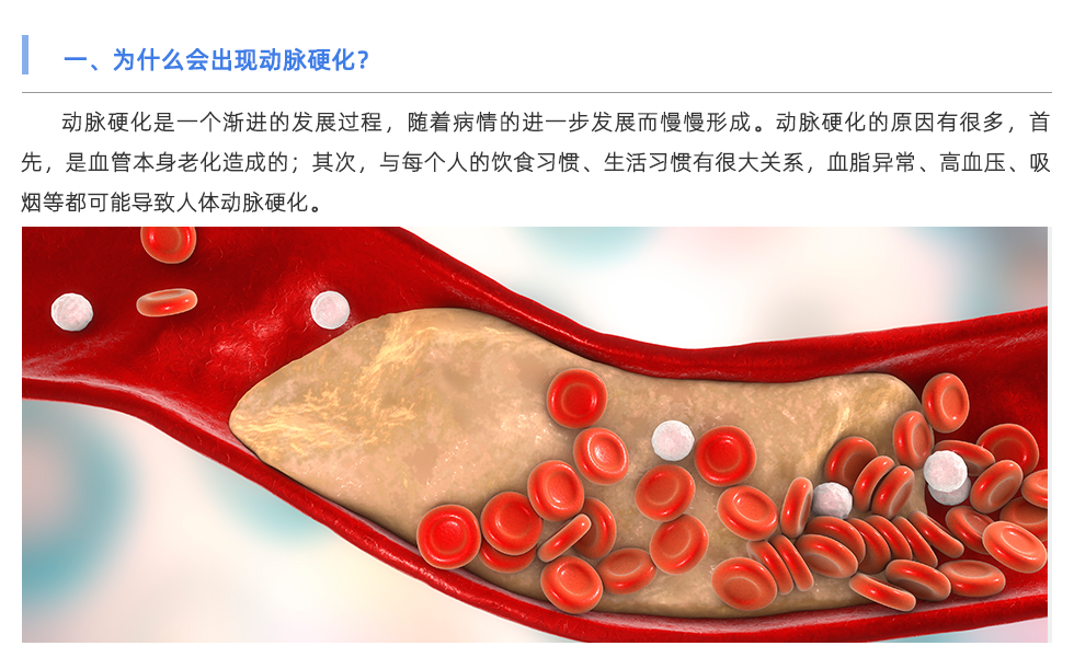 動脈硬化分析儀