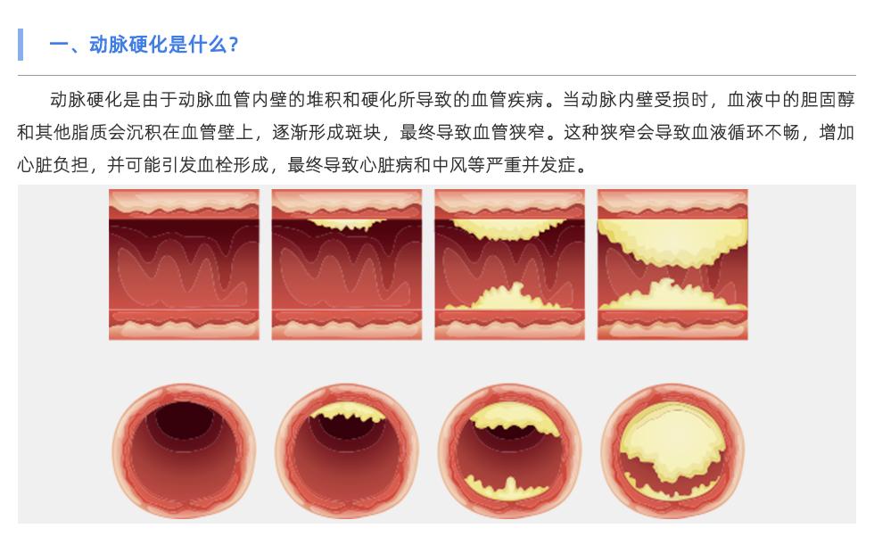 動(dòng)脈硬化分析儀