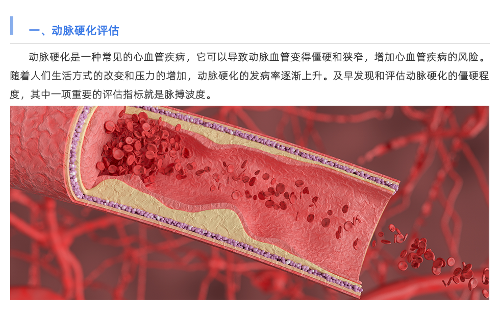 動(dòng)脈硬化檢測(cè)儀