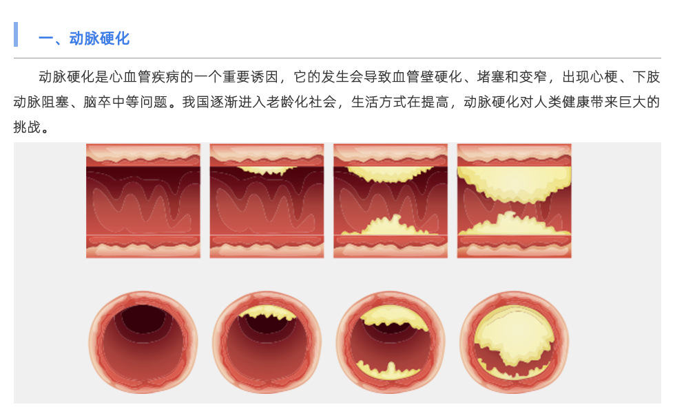 動脈硬化檢測儀