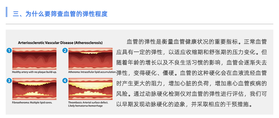 動(dòng)脈硬化檢測(cè)儀