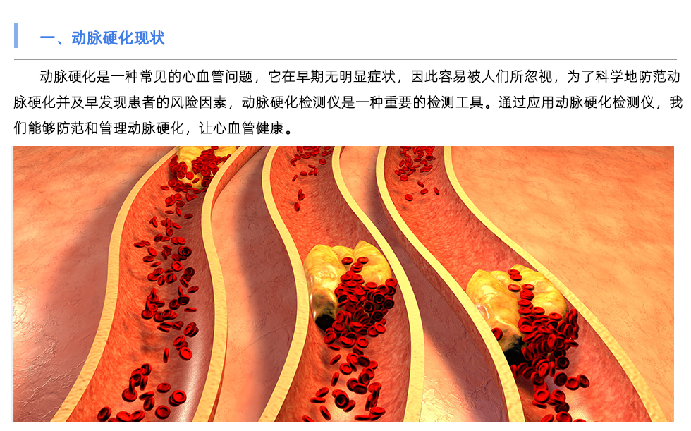 動(dòng)脈硬化檢測(cè)儀