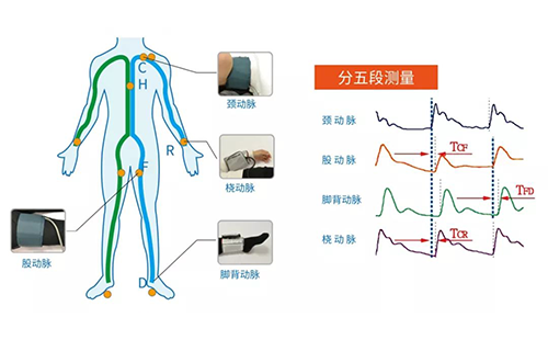 動(dòng)脈硬化檢測儀