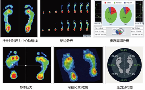 足底壓力檢測儀