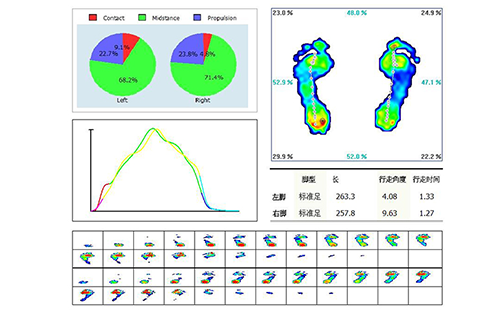 足底壓力分析儀