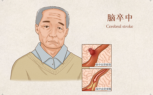 脈搏波速測定儀