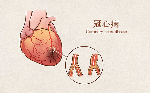 動脈硬化分析儀